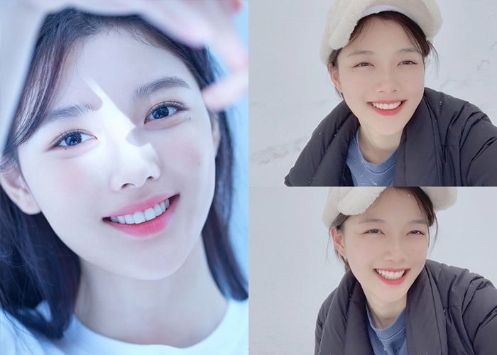 Mặt mộc dàn sao Hàn “không dao kéo”: Kim Yoo Jung vẫn xinh đáo để