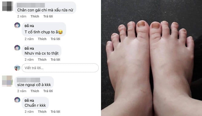 Những bàn chân kém xinh khiến sao nữ Vbiz