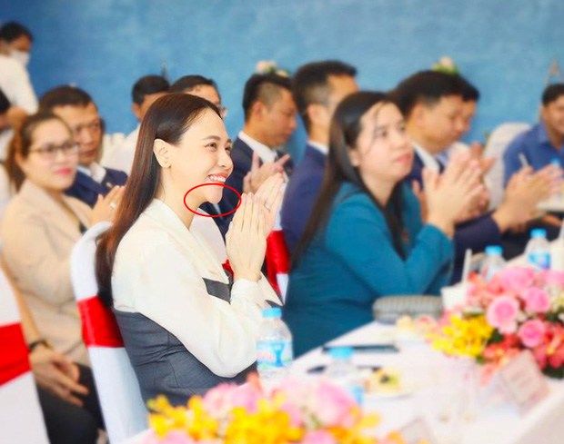 Sau chiếc cằm nhọn, Đàm Thu Trang bị đào ảnh cũ vì nghi thẩm mỹ