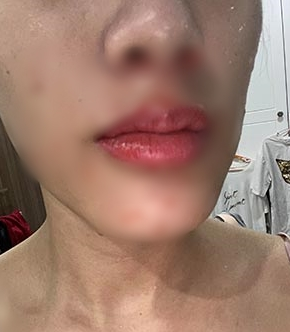 Tắm đêm, cô gái bất ngờ ngã gục, cứng người 10 phút mới kêu cứu được