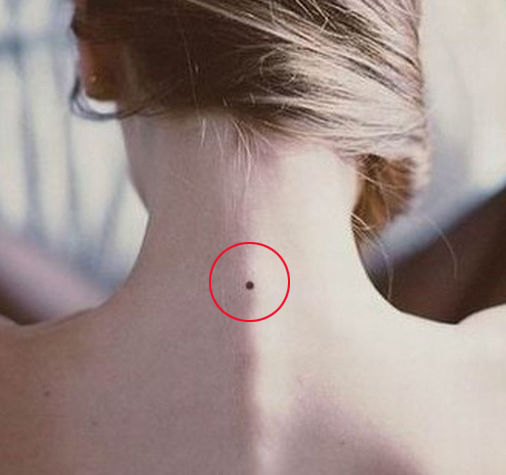 5 vị trí nốt ruồi trên lưng tiết lộ cuộc sống bạn