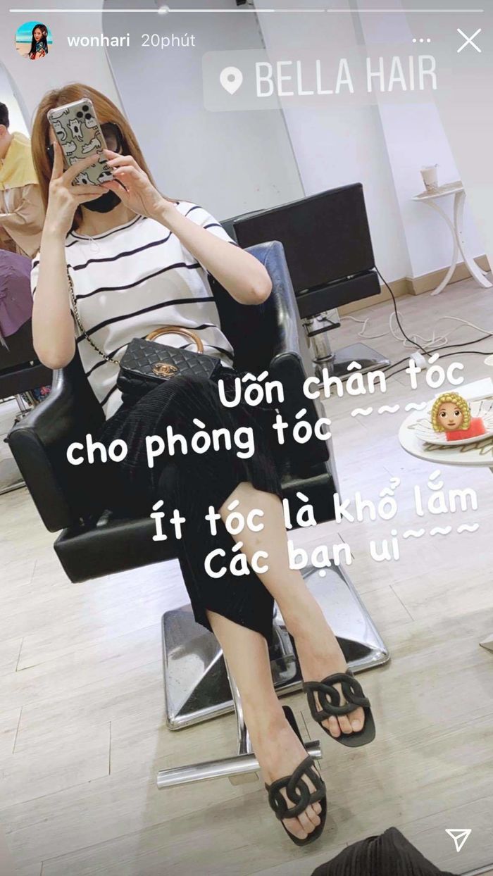 Để che khuyết điểm chân tóc: Hari Won dập phồng, Lynk Lee phải cắt da