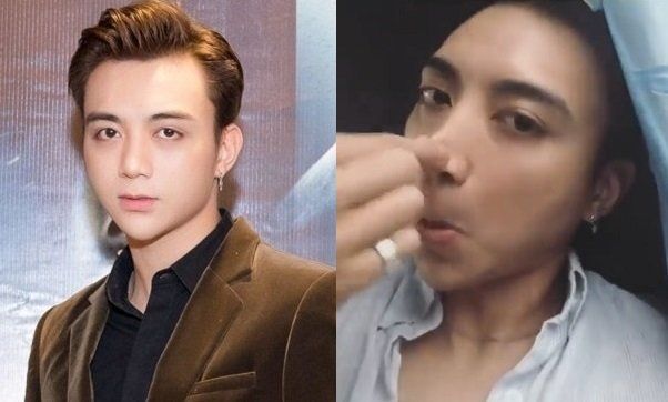 Sao Việt gây tiếc nuối vì dao kéo: Tường Vi lệch cả mũi