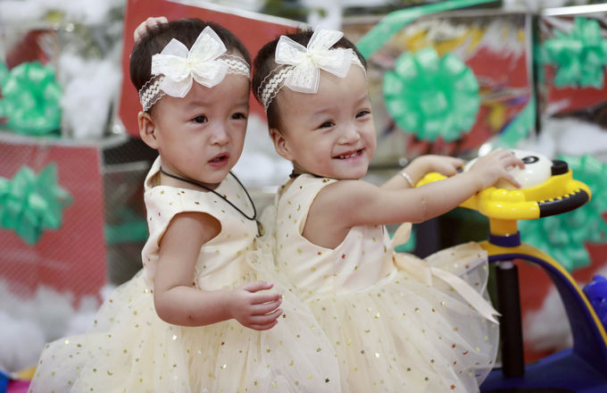 Sau 5 tháng mổ tách dính, Trúc Nhi, Diệu Nhi đã biết đi