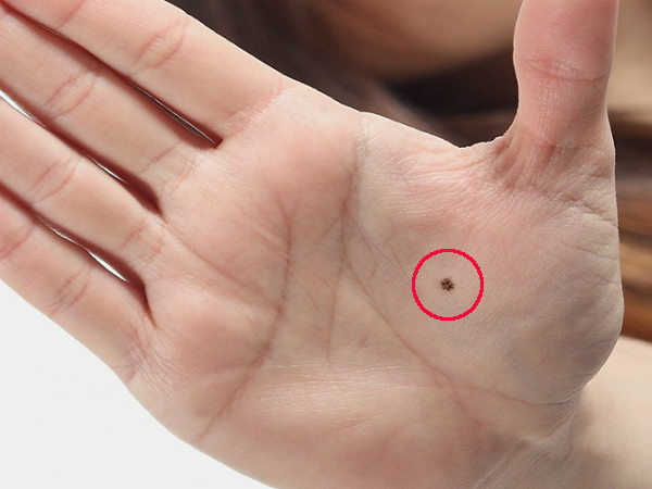 6 vị trí nốt ruồi báo hiệu người sở hữu phúc khí ngập nhà