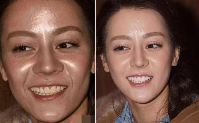 Những thảm họa mà mỹ nhân Hoa Ngữ muốn xóa bỏ vĩnh viễn