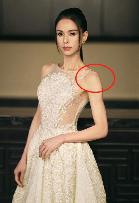 Lý Nhược Đồng lộ đôi vai nhọn hoắt, body xương xẩu