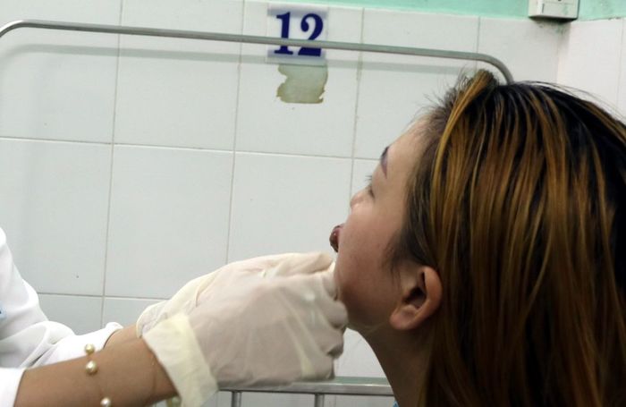 Cô gái bị biến chứng nguy hiểm vì xăm môi