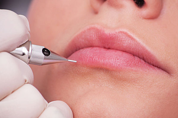 Cô gái bị biến chứng nguy hiểm vì xăm môi