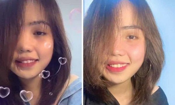 Cô gái bị tạt axit đã phục hồi nhan sắc sau 2 năm