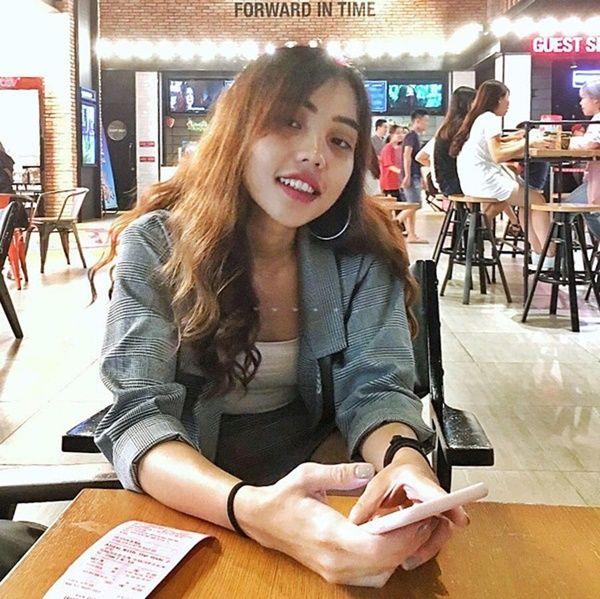 Cô gái bị tạt axit đã phục hồi nhan sắc sau 2 năm