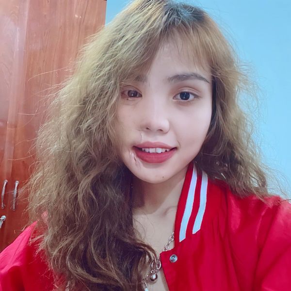 Cô gái bị tạt axit đã phục hồi nhan sắc sau 2 năm