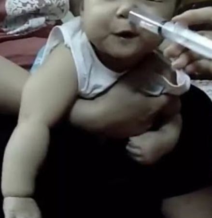 Em bé 2,5 tháng tuổi ngưng thở vì rửa mũi bằng nước muối