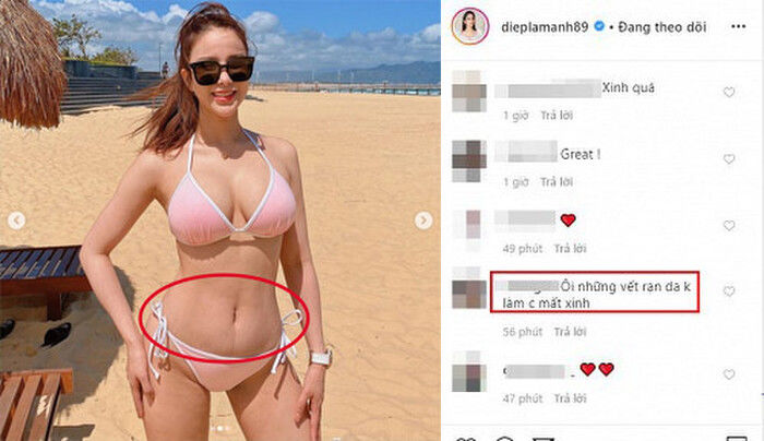 Mặc bikini sau sinh: Hà Hồ, Diệp Lâm Anh bị soi khuyết điểm