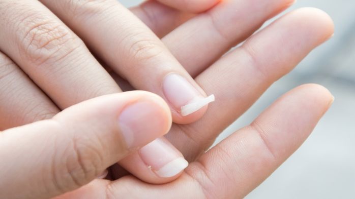 Những dấu hiệu khi cơ thể bị thiếu chất cần được bổ sung