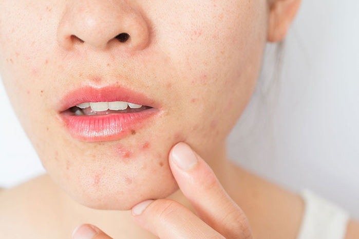 4 triệu chứng ngầm cảnh báo tình trạng suy buồng trứng sớm