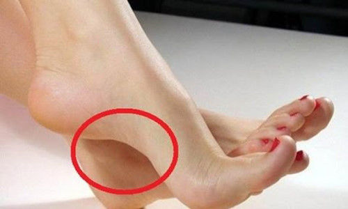 5 dấu hiệu ở bàn chân cho thấy bạn có số đại phú quý