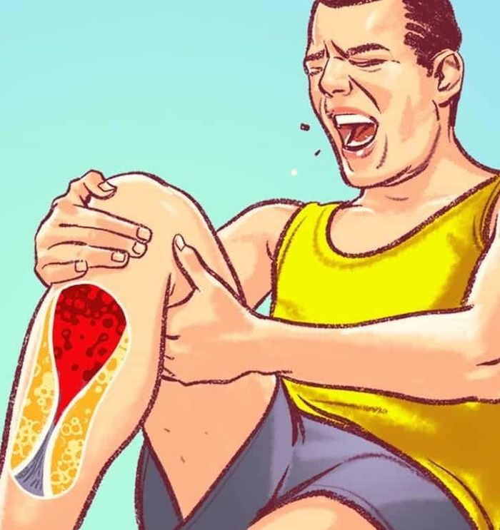 7 dấu hiệu cảnh báo tắc nghẽn động mạch, người trẻ càng cần chú ý