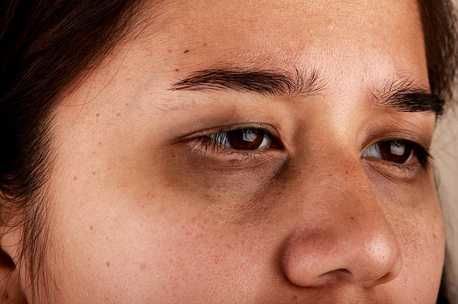 7 dấu hiệu cơ thể báo hiệu tình trạng suy thận