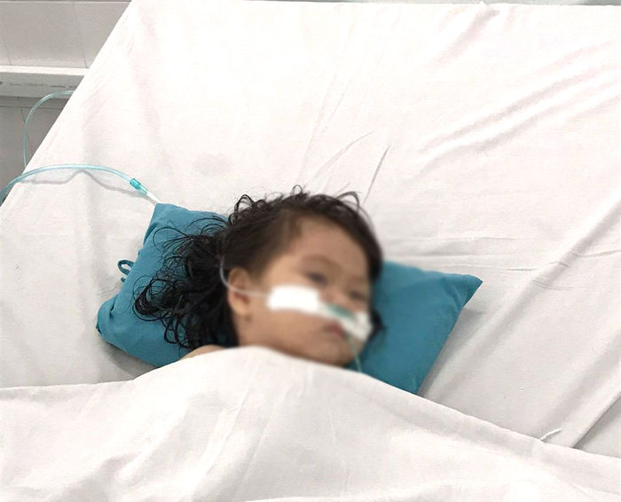 Bé gái bị tổn thương phổi, suy hô hấp vì uống nhầm dầu parafin