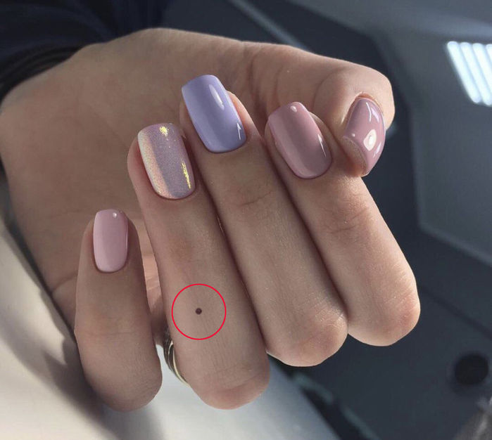Vị trí nốt ruồi trên ngón tay có ý nghĩa gì?