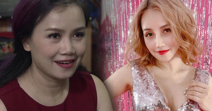 Những diễn viên Vbiz công khai dao kéo”