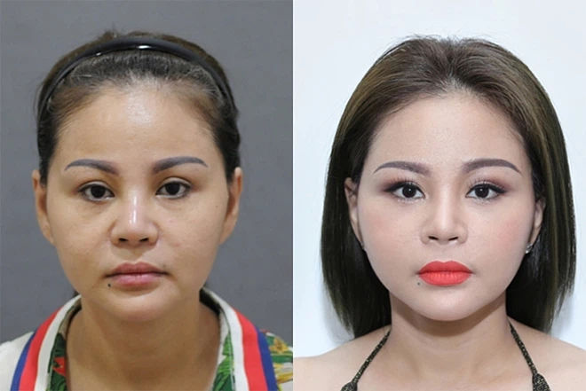 Nhan sắc danh hài Lê Giang khi chưa dao kéo