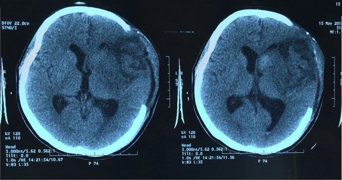 BS cảnh báo: Cứ sốt, mệt mỏi đã vội truyền dịch là thói quen nguy hiểm