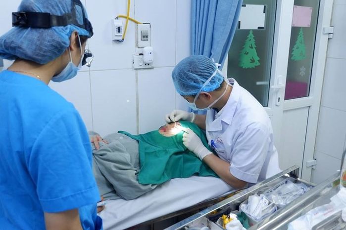 Cô gái 23 tuổi bị mù mắt trái, mắt phải bị bóng mờ vì cắt mí ở spa