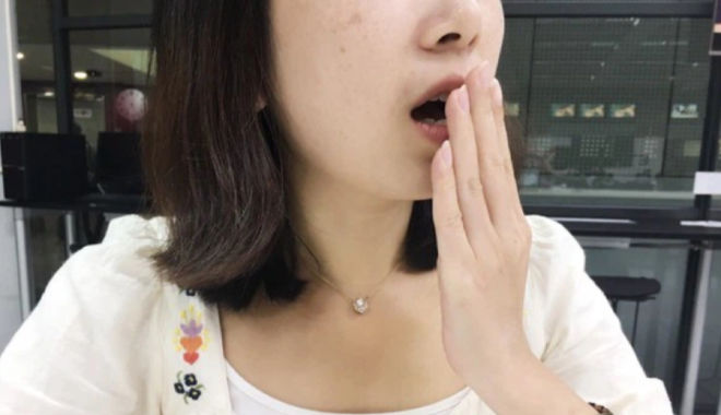 Cô gái 20 tuổi mắc trào ngược dạ dày vì bỏ bữa sáng