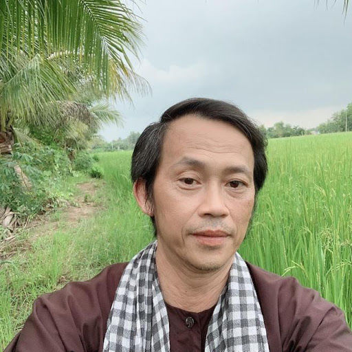 Hoài Linh: Tôi muốn thẩm mỹ để níu kéo thanh xuân
