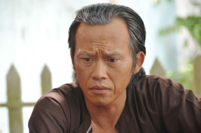 Hoài Linh: Tôi muốn thẩm mỹ để níu kéo thanh xuân