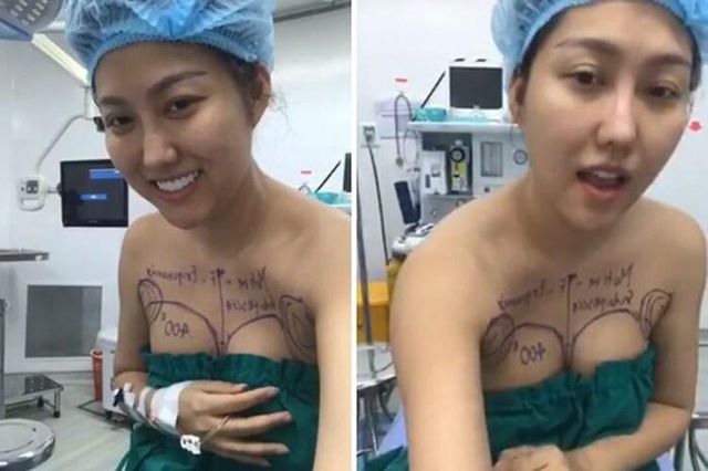 Những kỷ lục dao kéo của sao Việt