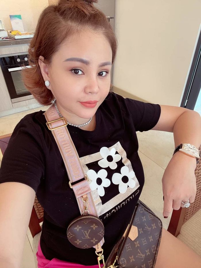 Những kỷ lục dao kéo của sao Việt