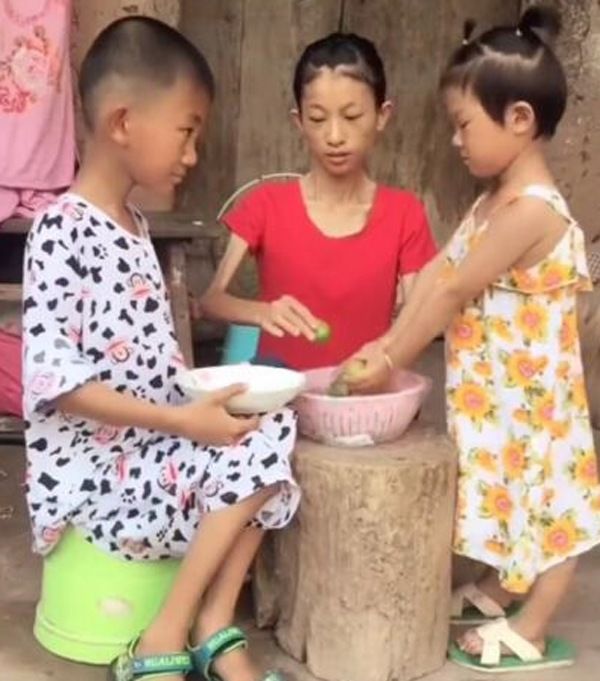Người phụ nữ nặng có 20kg vẫn sinh 2 con và kết quả đau lòng
