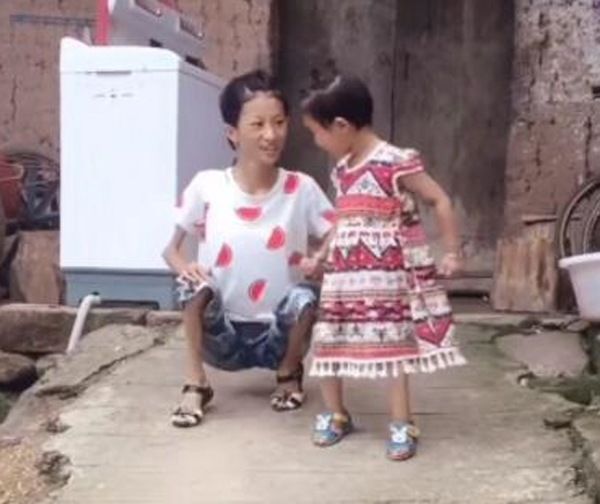 Người phụ nữ nặng có 20kg vẫn sinh 2 con và kết quả đau lòng