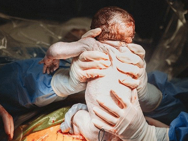 Mẹ bầu chịu đau đớn và áp lực nhiều hơn gấp bội khi sinh mổ lần hai