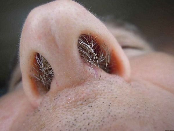 Nam thanh niên qua đời vì thường xuyên nhổ lông mũi