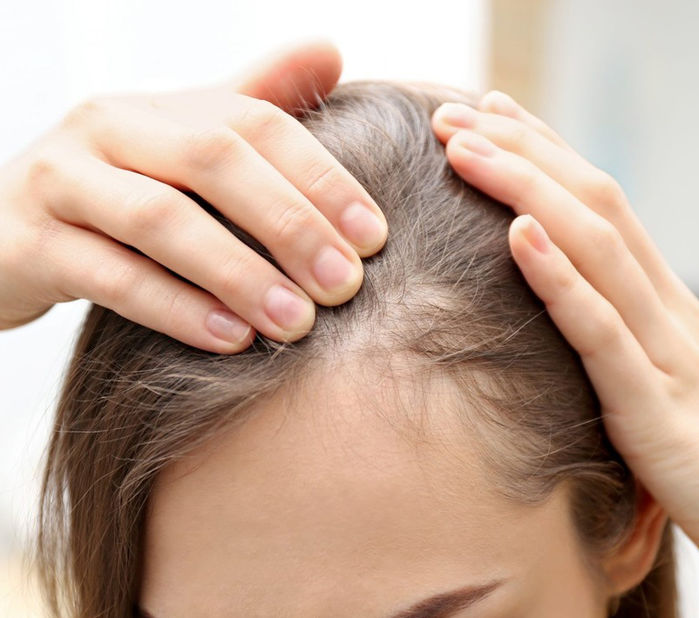 Tác hại của việc gội đầu quá nhiều