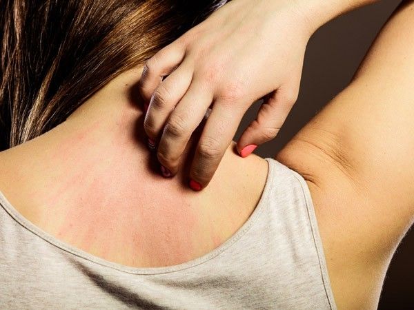 4 biểu hiện ở làn da cho thấy thận đang bị nhiễm độc