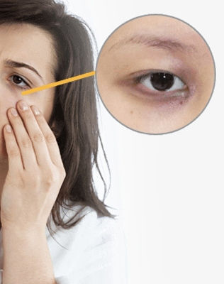 4 điểm xấu xí trên gương mặt cảnh báo tử cung không khoẻ
