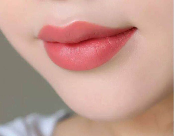 Phun môi collagen, cô gái khóc ròng vì môi nứt nẻ, chảy máu đen xì