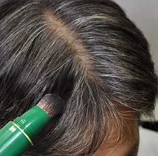 Nhuộm tóc 4 lần/năm, cụ ông 72 tuổi bị nan y giai đoạn cuối
