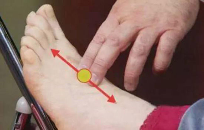 3 cách kiểm tra nguy cơ bị tắc nghẽn mạch máu tại nhà