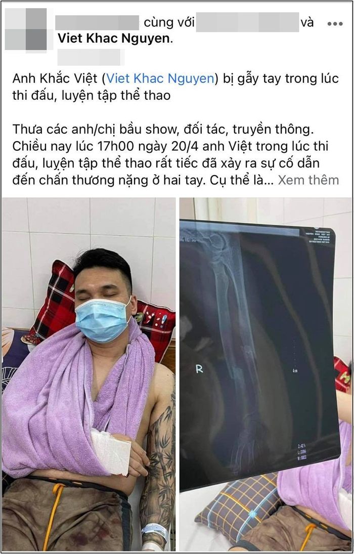 Khắc Việt gãy tay hủy show hàng loạt