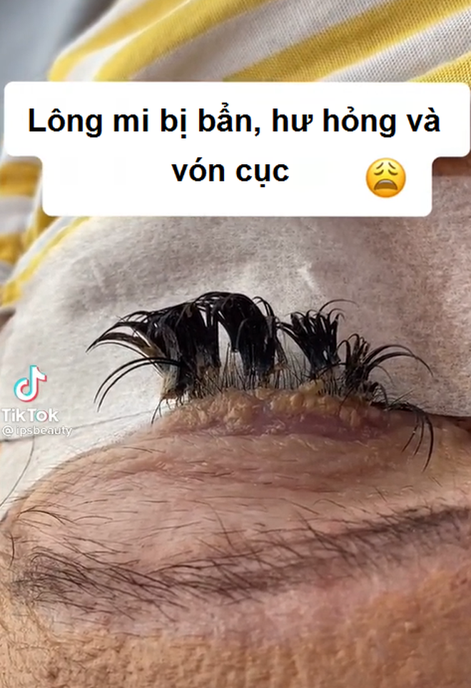 Nối mi giả nhưng lười vệ sinh, cô gái hốt hoảng khi mảng bẩn vón cục