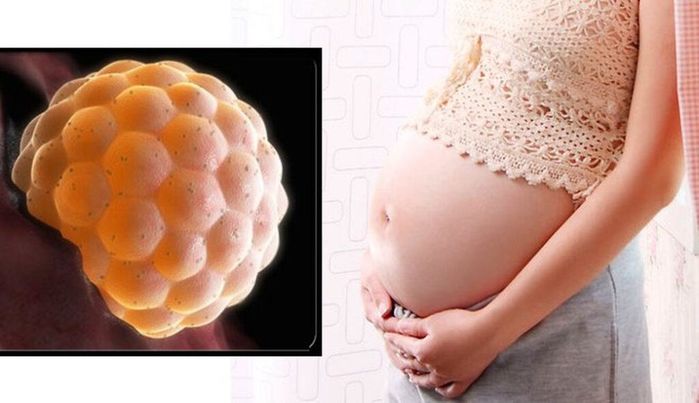 50 tuổi bất ngờ mang thai, người phụ nữ phải cắt bỏ tử cung