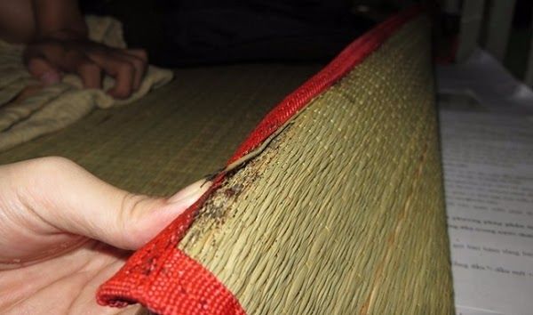 Người phụ nữ suýt nhiễm trùng máu vì rệp giường cắn