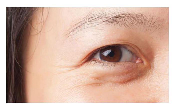3 chỗ ngày càng to, 2 thứ ngày càng ít chứng tỏ đang lão hóa nhanh