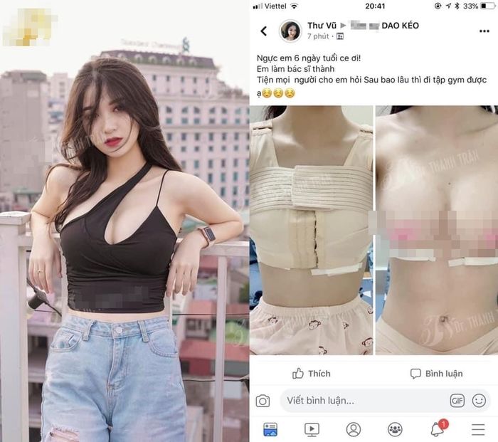 Hết ảnh quá khứ khác lạ, Vũ Thị Anh Thư lại lộ bằng chứng nâng cấp
